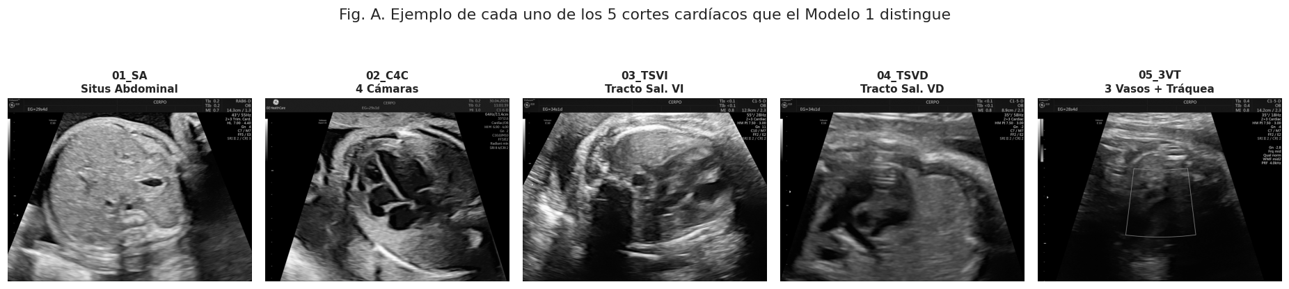 Ejemplo representativo de cada uno de los 5 cortes cardíacos fetales: 01_SA, 02_C4C, 03_TSVI, 04_TSVD, 05_3VT